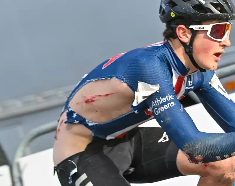 AJ August, after a "cross" fall at the World Championships, takes to the road with the U.S. Devo team.